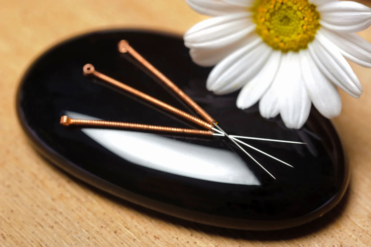 acupuncture-needles-on-tray-sm